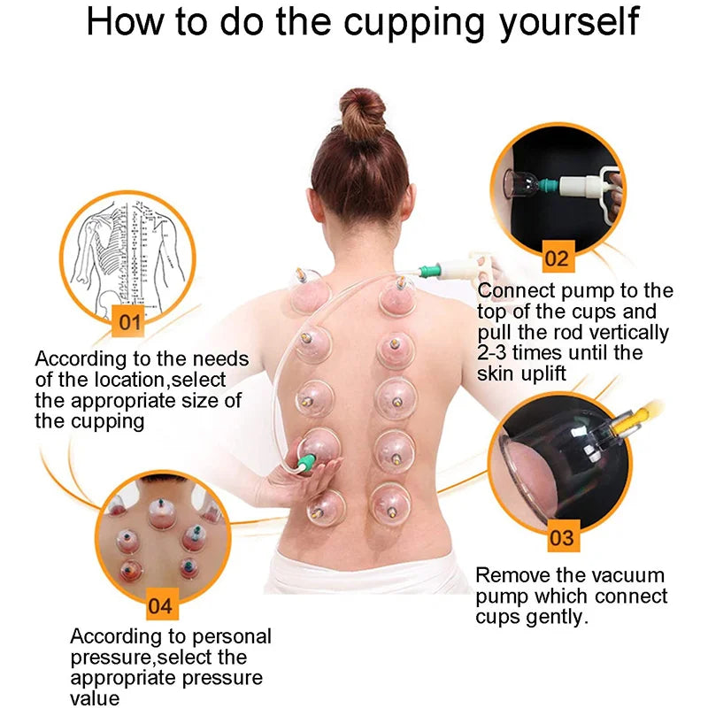 6 or 24 Pieces Suction Cups Massage Vacuum Cupping Body Massager Plastic Vacuum Suction Therapy Cupping Set Cans for Massage